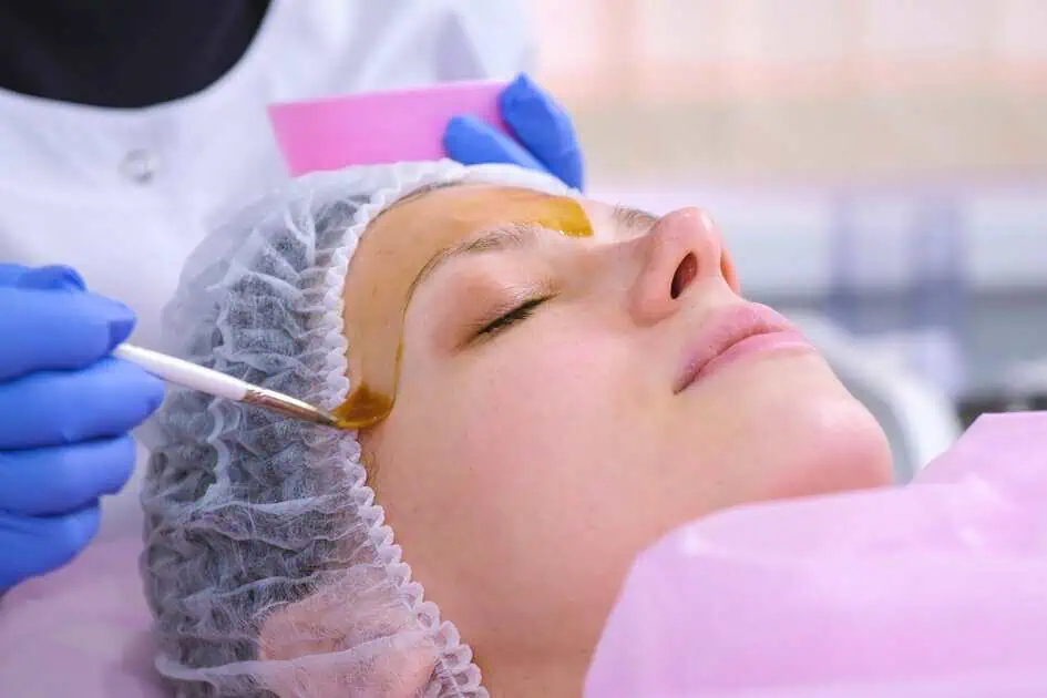 Chemical Peels In Tallahassee, FL by Earth Remedies