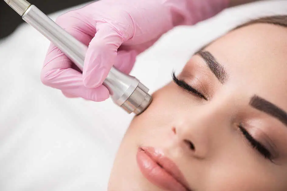 Diamond Microdermabrasion in Tallahassee, FL by Earth Remedies